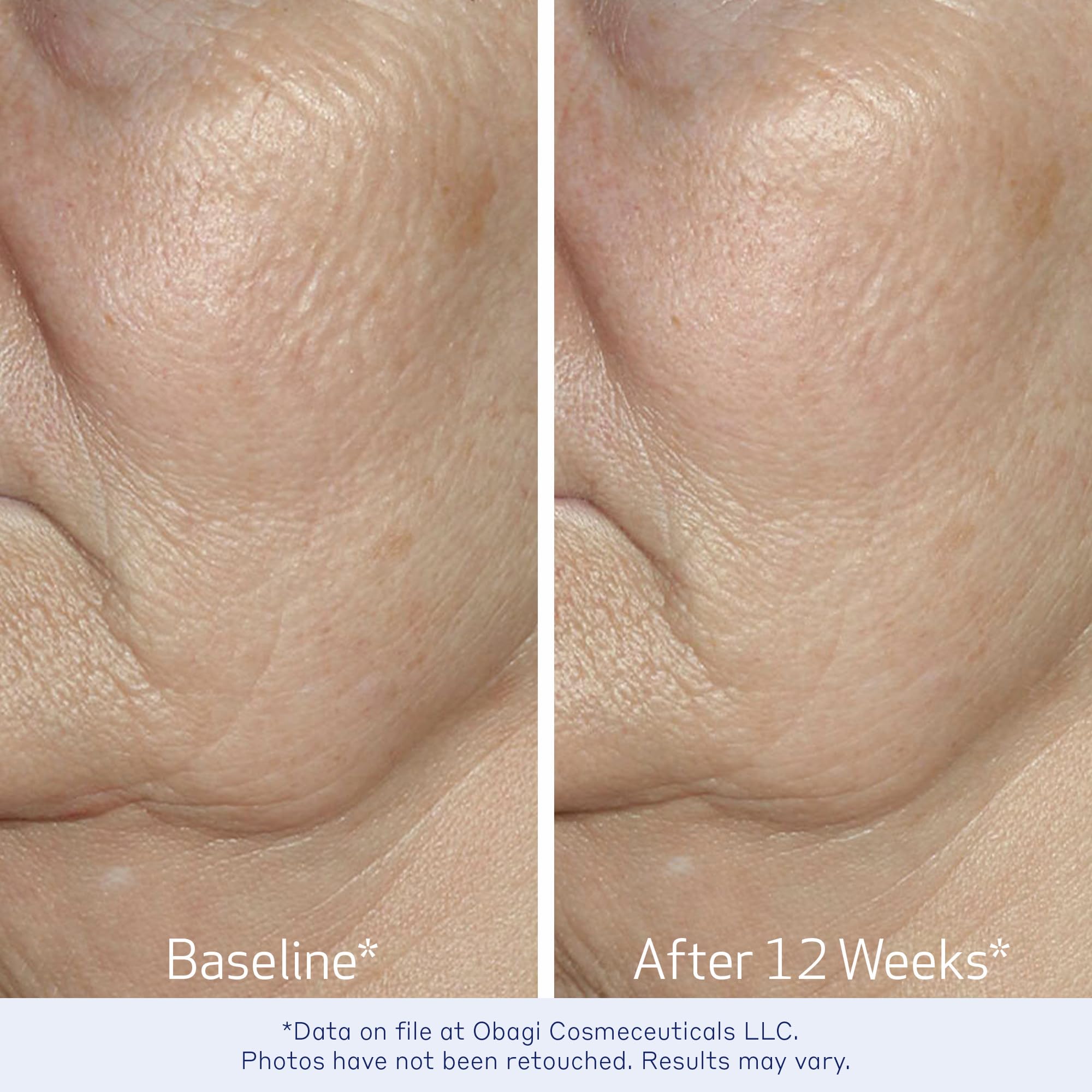 Obagi ELASTIderm Facial Serum – Firming Face Serum with Patented Bi-Mineral Contour Complex Clinically Proven to Target Signs Of Skin Aging