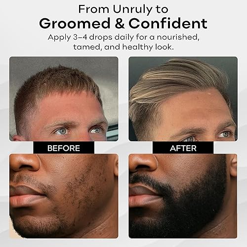 Miniatura 8 de BAHAWAT Aceite para barba, acondicionador y suavizante de aceite para barba de alta calidad, aroma de barbería, elimina la picazón de la barba,