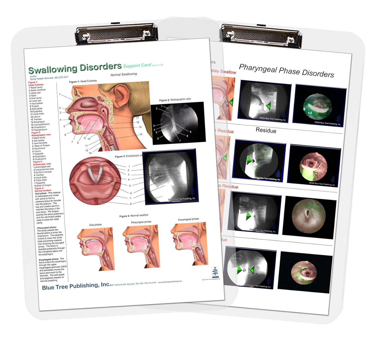 Swallowing Disorders Insert Clipboard