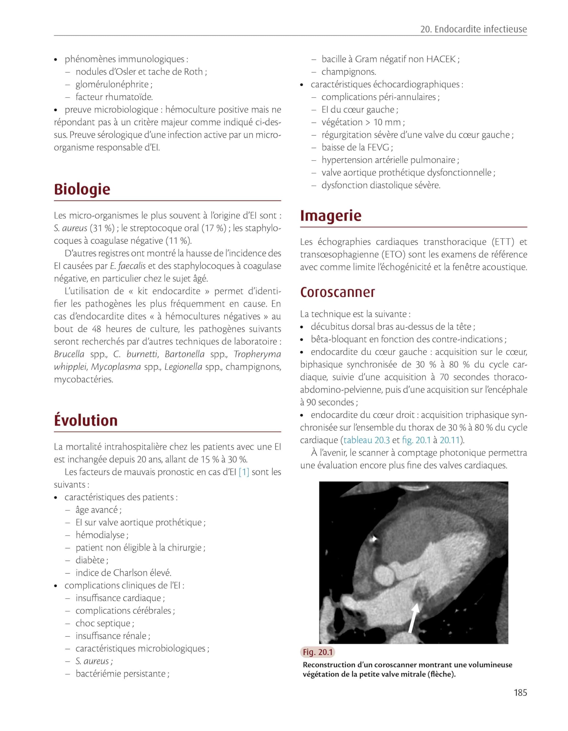 Radiologie cardiaque