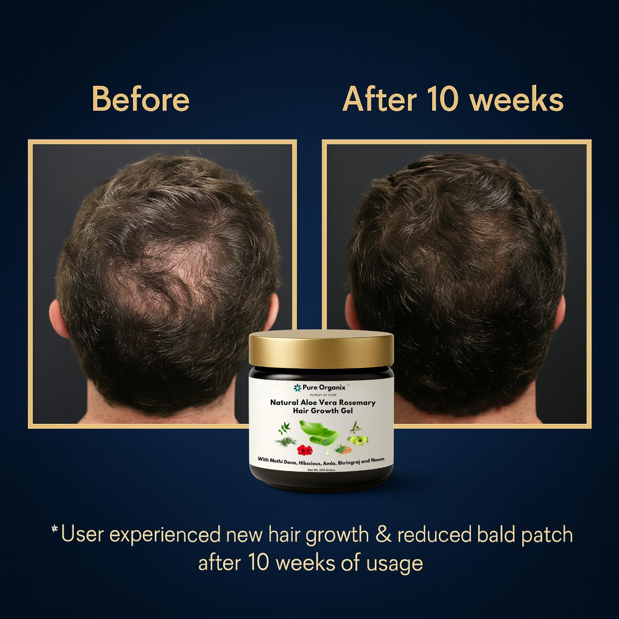 Buy Pure Organix Natural Hair Growth Gel | Organic Aloe Vera, Rosemary,  Hibiscus, Bhringraj, Methi Dana, Neem & Amla | Natural Hair Regrowth & Hair  Fall Control Treatment | All-Natural, No Chemicals