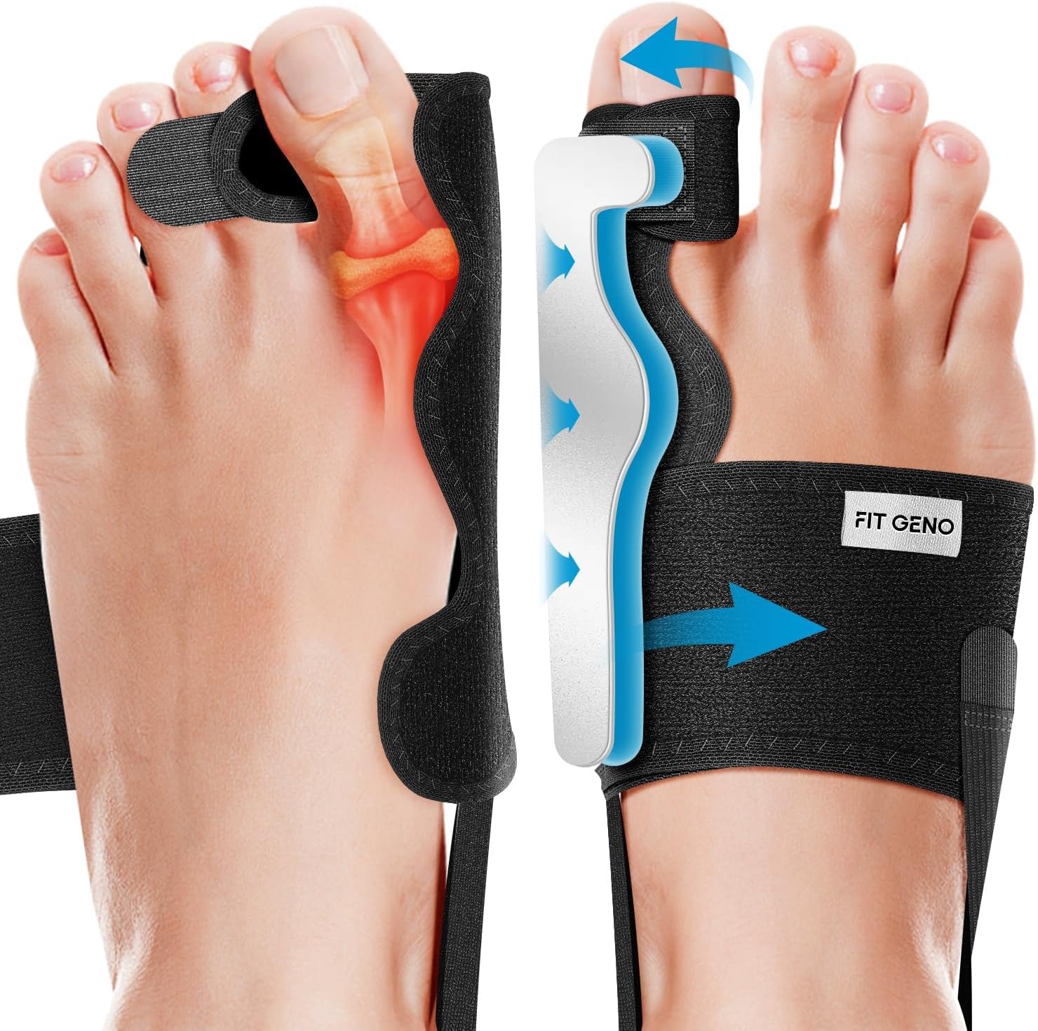 Fit Geno Bunion Corrector Women & Men Big Toe: Foot Straightener Splint Brace - Adjustable Bunyan Correction Orthopedic for Hallux Valgus Pain Relief 2 Pcs