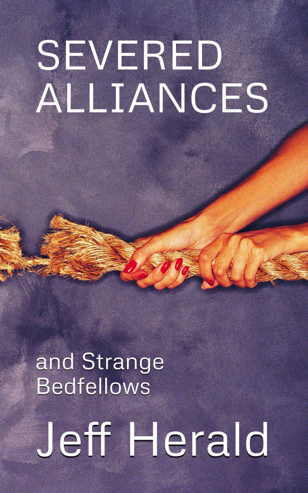 SEVERED ALLIANCES: and Strange Bedfellows