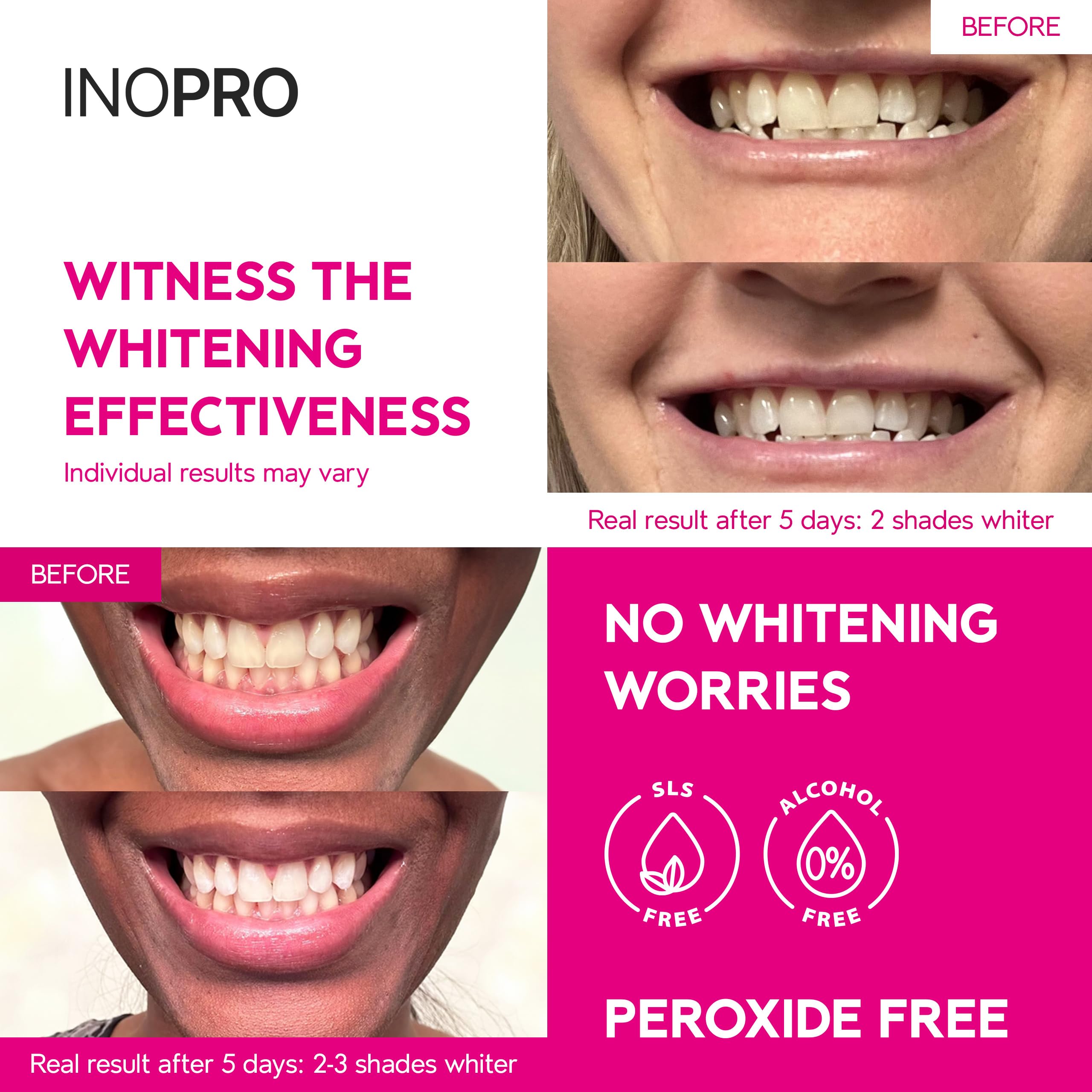 InoPro Teeth Whitening Strips 21 Treatments Kit - Teeth Whitener, Peroxide Free, Green White Strips for Teeth Whitening with Arbutin, Coconut Oil, Deep Stains Removal (42 Strips)