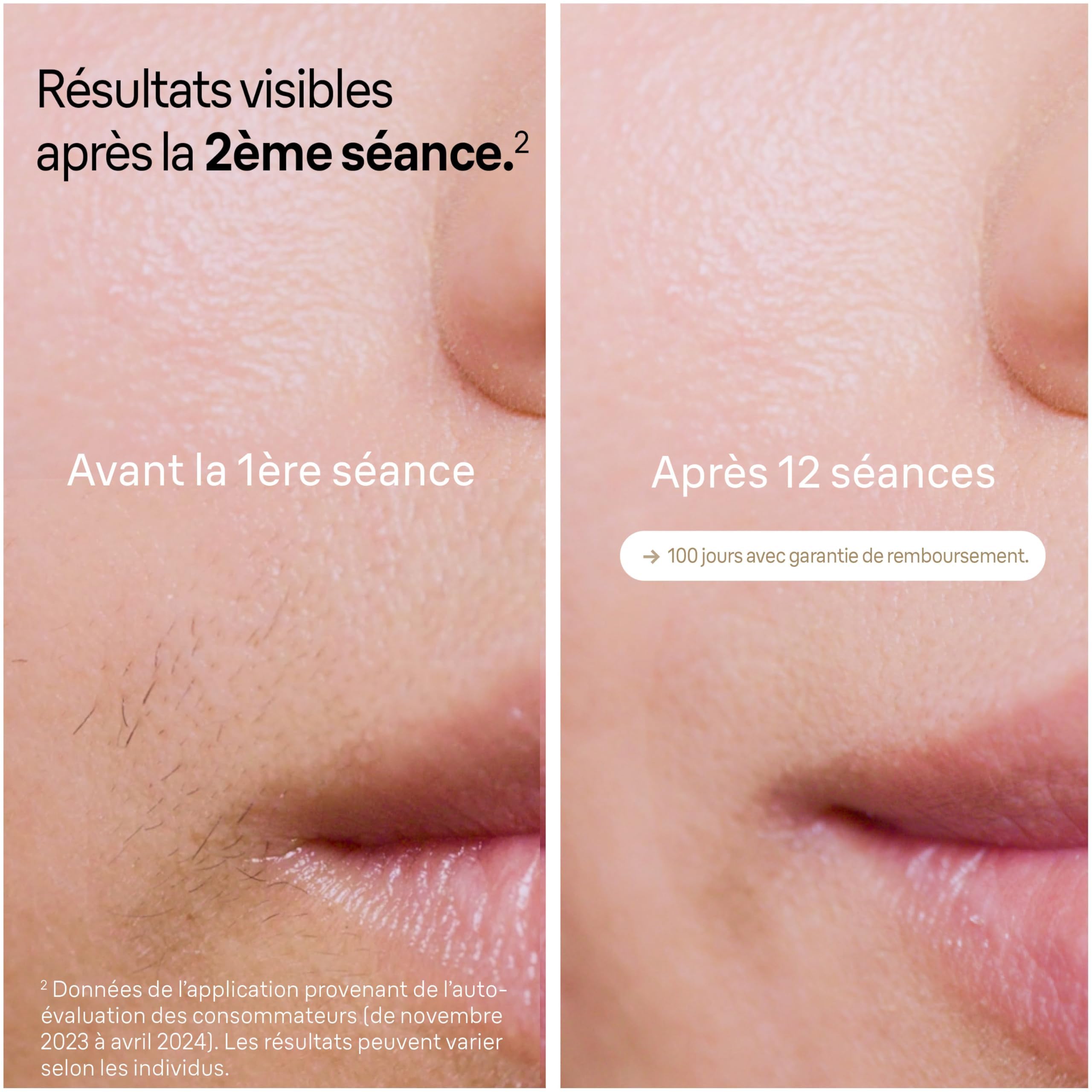 Braun Epilateur Lumiere Pulsee Silk·expert Pro 5, Epilation Semi-Définitive, Alternative Au Laser, Résultats En 2 Séances, Têtes Pour Épiler Jambes, Visage, Maillot Et Plus