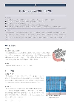 十二指腸腫瘍の内視鏡治療とマネジメント／小山恒男(編著),矢作直久(編著) Amazon.co.jp: 十二指腸腫瘍の内視鏡治療とマネジメント : 小山