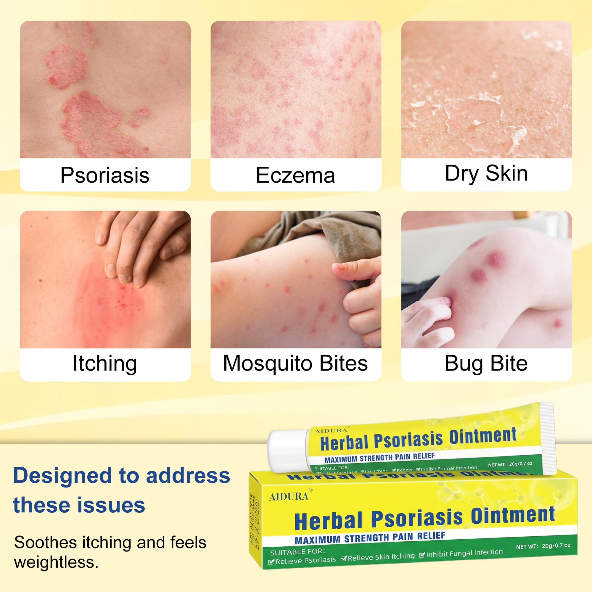 Psoriasis Cream, Natural Seborrheic Dermatitis Relief for Itchy Flaky Skin, Soothing Ointment for Redness & Scaling 20g - 3
