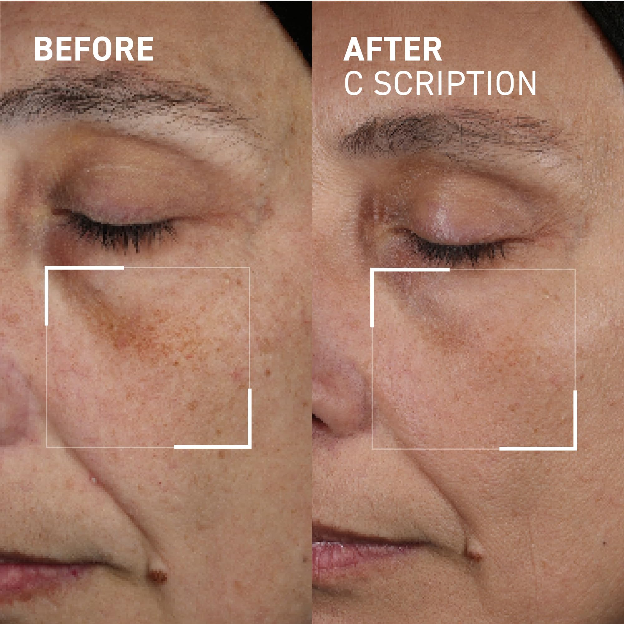 Dr. Brandt Bright This Way C Scription - Concentrated Vitamin C Serum - Fade Dark Spots, Reduce Wrinkles & Illuminate Skin Tone - 30 mL - Image 3