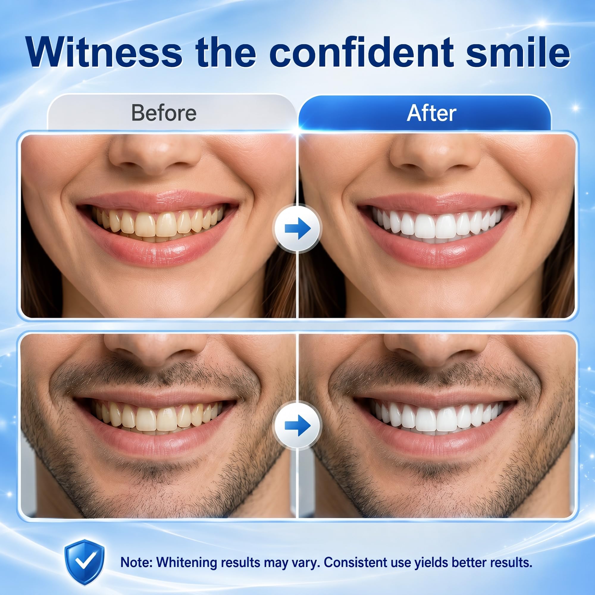 Codecure Teeth Whitening Strips - Sensitive Teeth -4