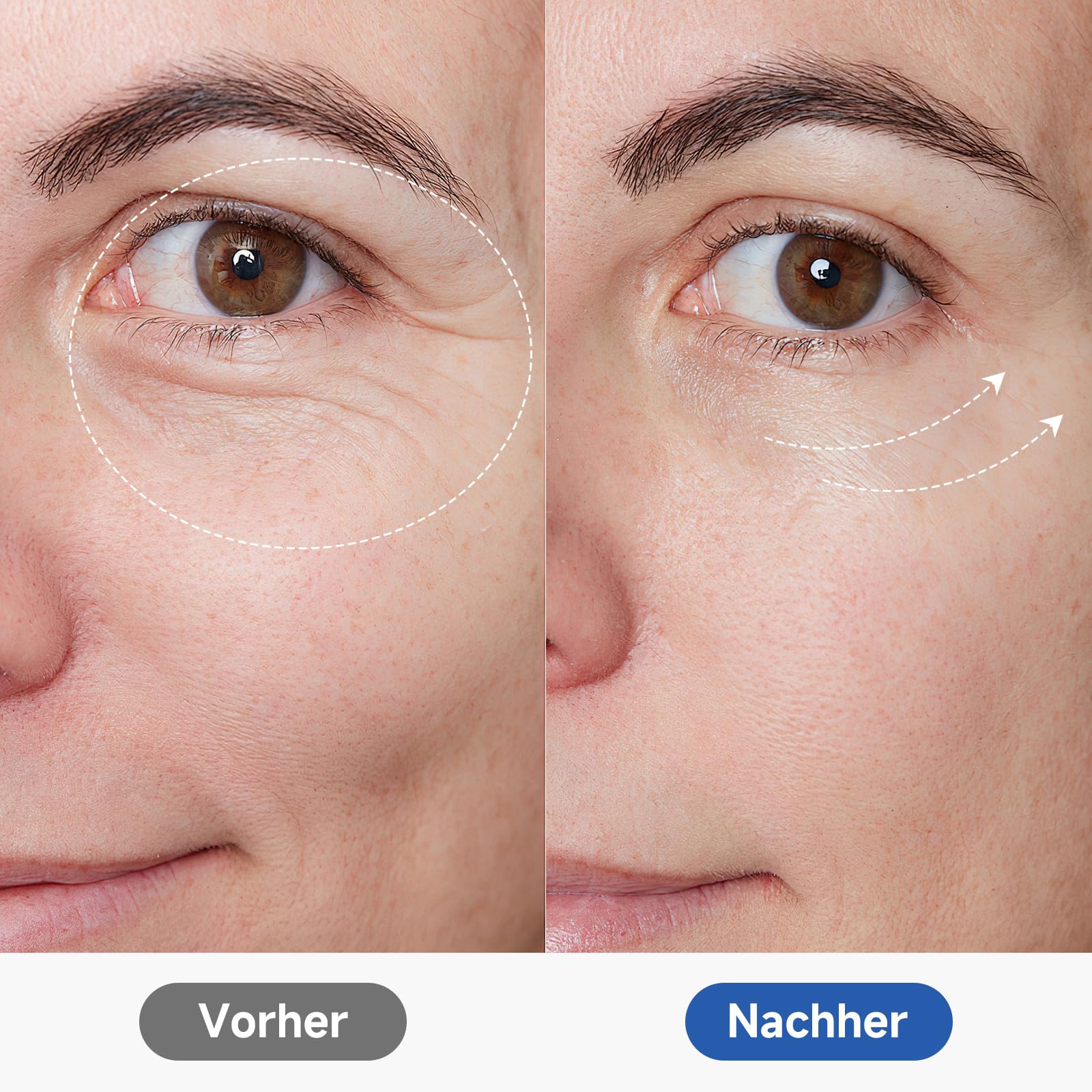 6-in-1 Kavitationsgerät Anti-Fett-Massagegerät mit Ultraschall-RF, EMS, rotem/blauem Licht, für Gesicht und Körper