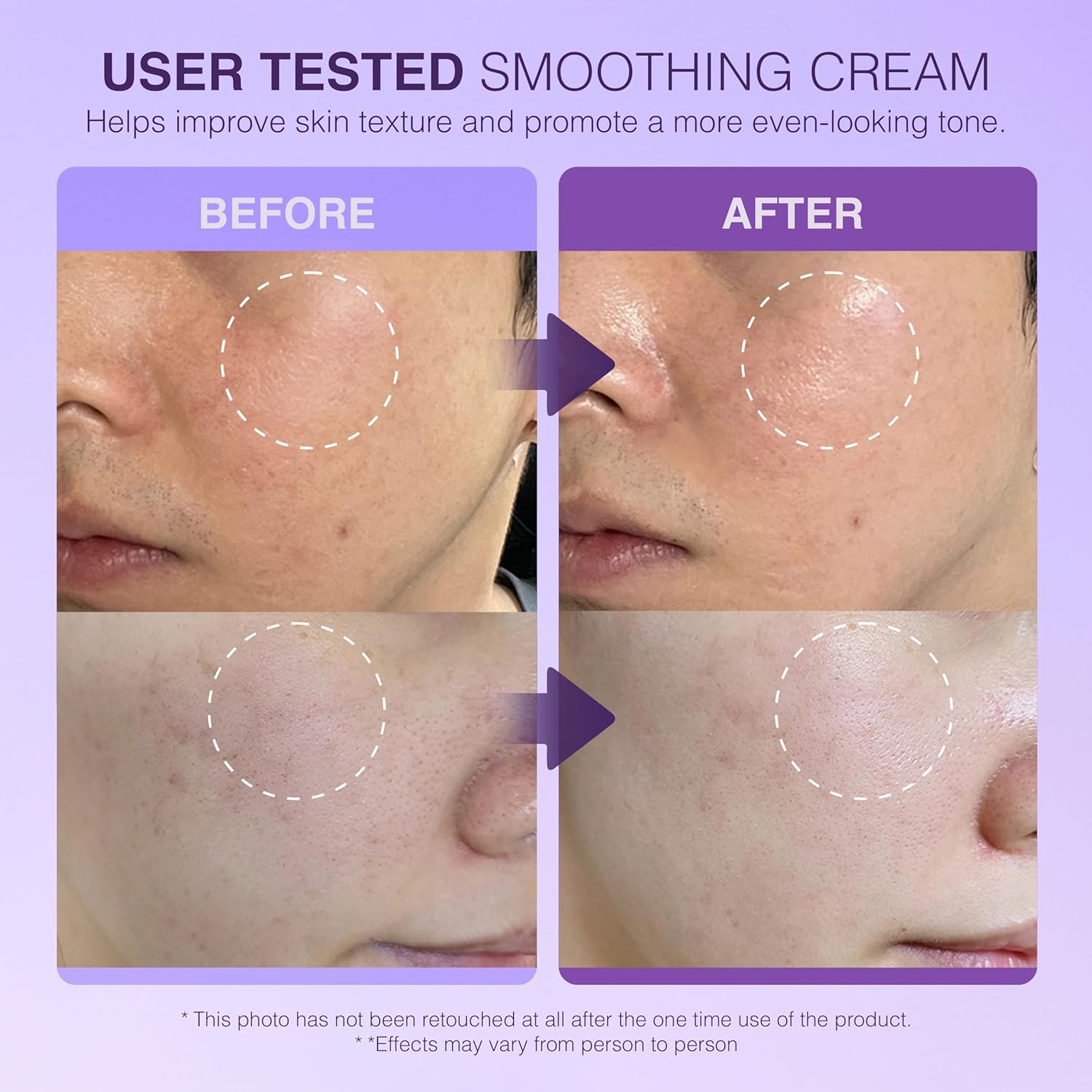 Be-Hope Vegan Luxury Comforting Cream – Soothing Moisturizer for Sensitive Skin with Purple Tea Extract, Adenosine, Plant-Based Ingredients – Anti-Wrinkle, 24-Hour Hydration – 50ml / 1.7 fl oz - Image 4