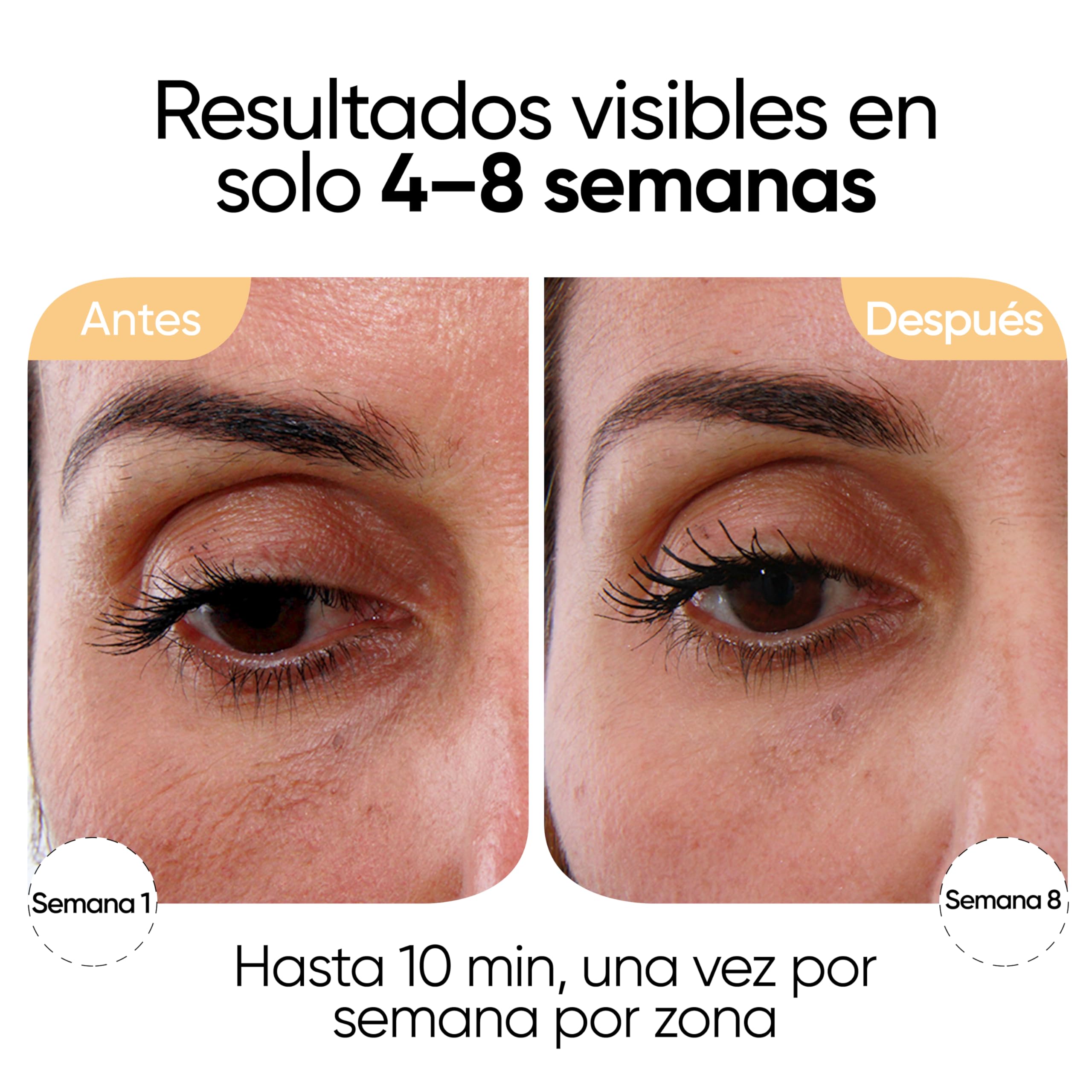 Sensica Sensilift Dispositivo de Radiofrecuencia Facial Antiedad – Aparato Reafirmante Profesional para Lifting Facial y Cuello, Antiarrugas, Tratamiento Antienvejecimiento en Casa