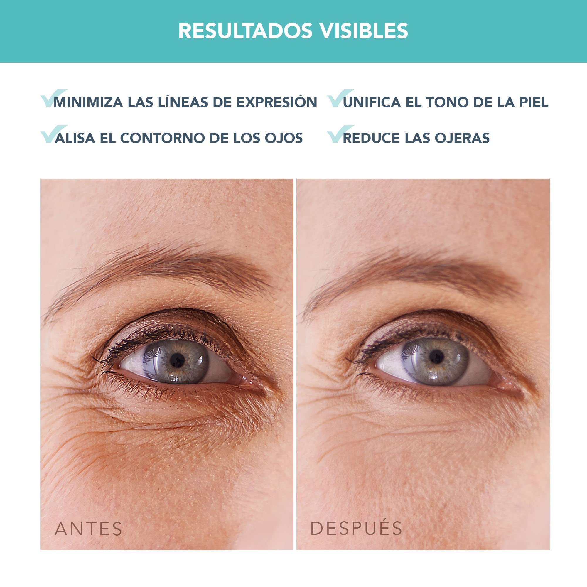 FOREO IRIS Parches Ojos com Colageno - Contorno de Ojos Antiojeras - Vitamina B, Vitamina C y Vitamina E - Retinol - Antiojeras Mujer - Hidratante - Vegano - 60 Parches Ojos Bolsas y Ojeras
