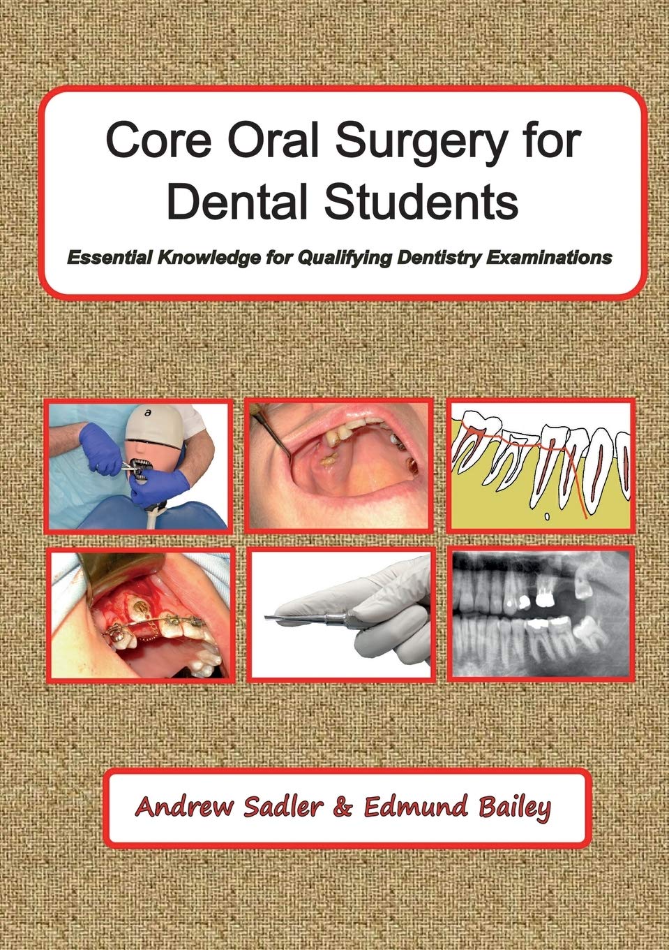 Core Oral Surgery For Dental Students: Essential Knowledge For Qualifying Dental Examinations 
