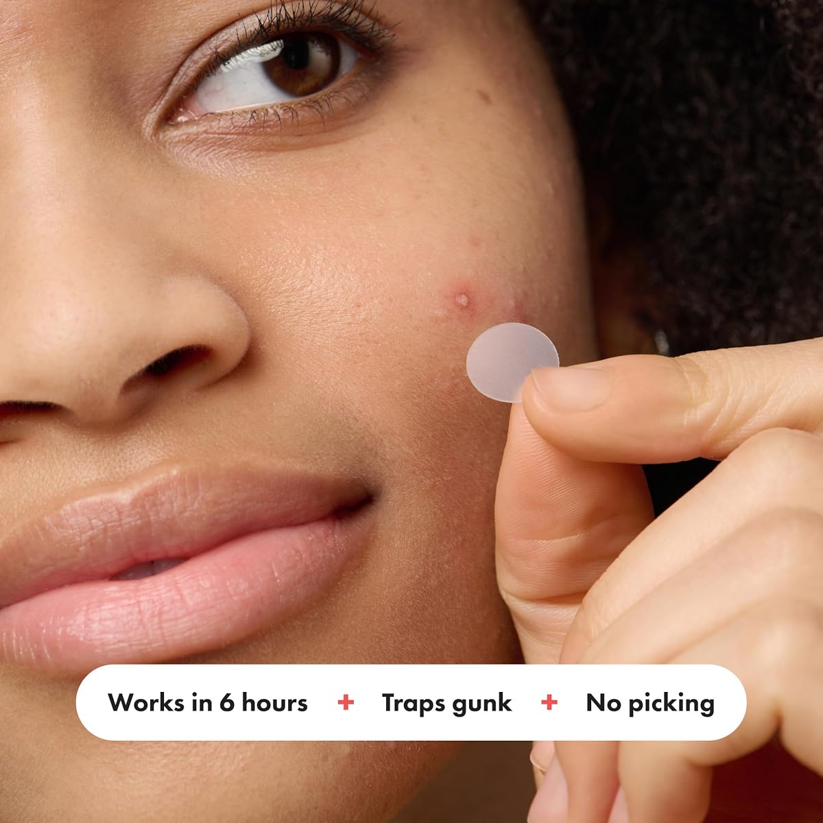 Acne Pimple Master Patch view 4