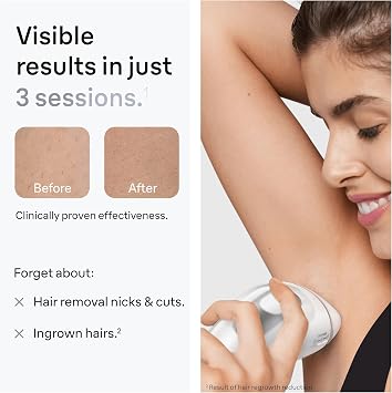 Braun IPL Silk·Expert Pro 3 at Home Hair Removal Device, Alternative for Laser Hair Removal, Includes Pouch, Venus Razor, Precision Head, 1 Year of Smooth Skin, Gift for Women, White/Silver, PL3121