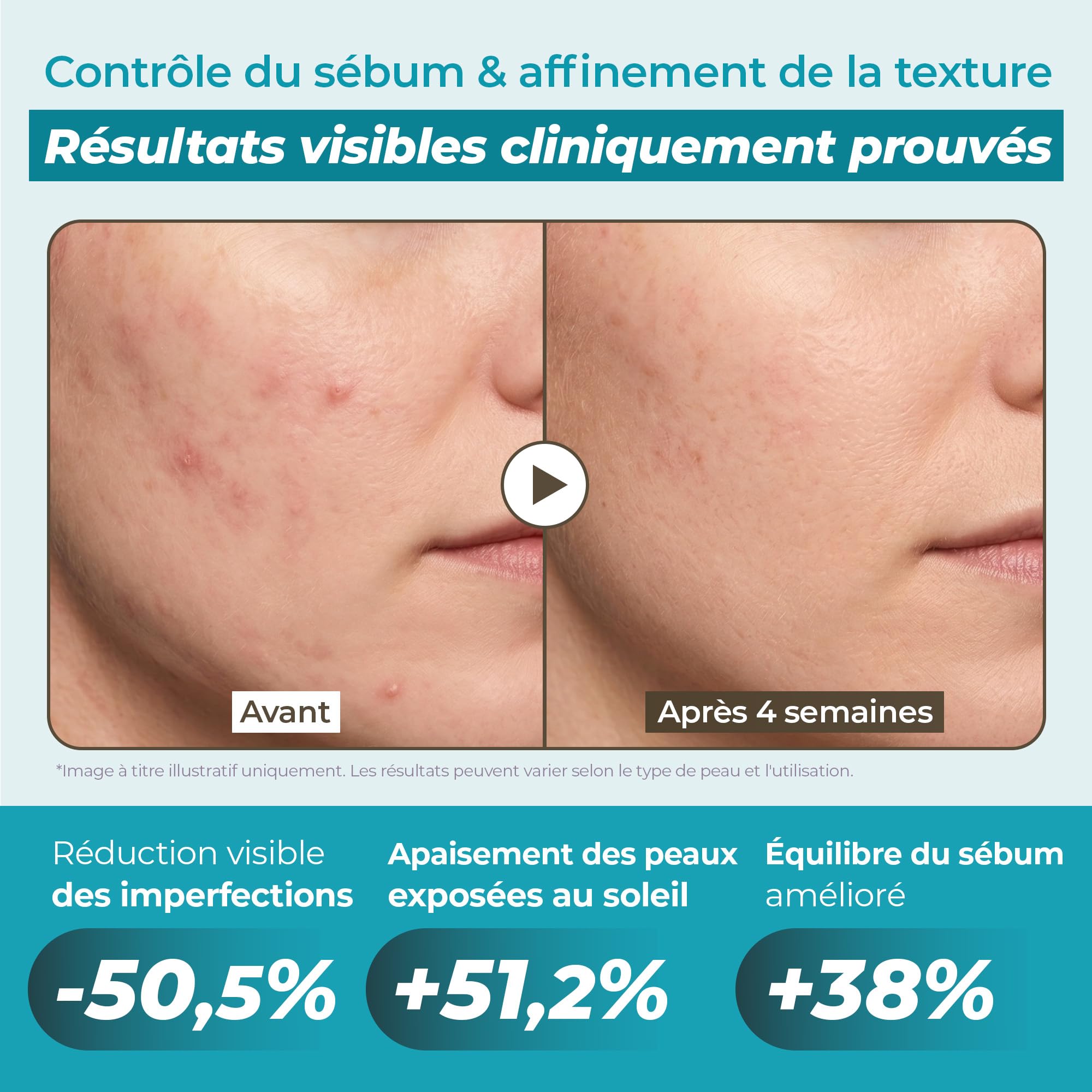JUMISO Mucine d'escargot 95% + essence de peptide, sérum hydratant pour peaux sèches, hydratation quotidienne en profondeur