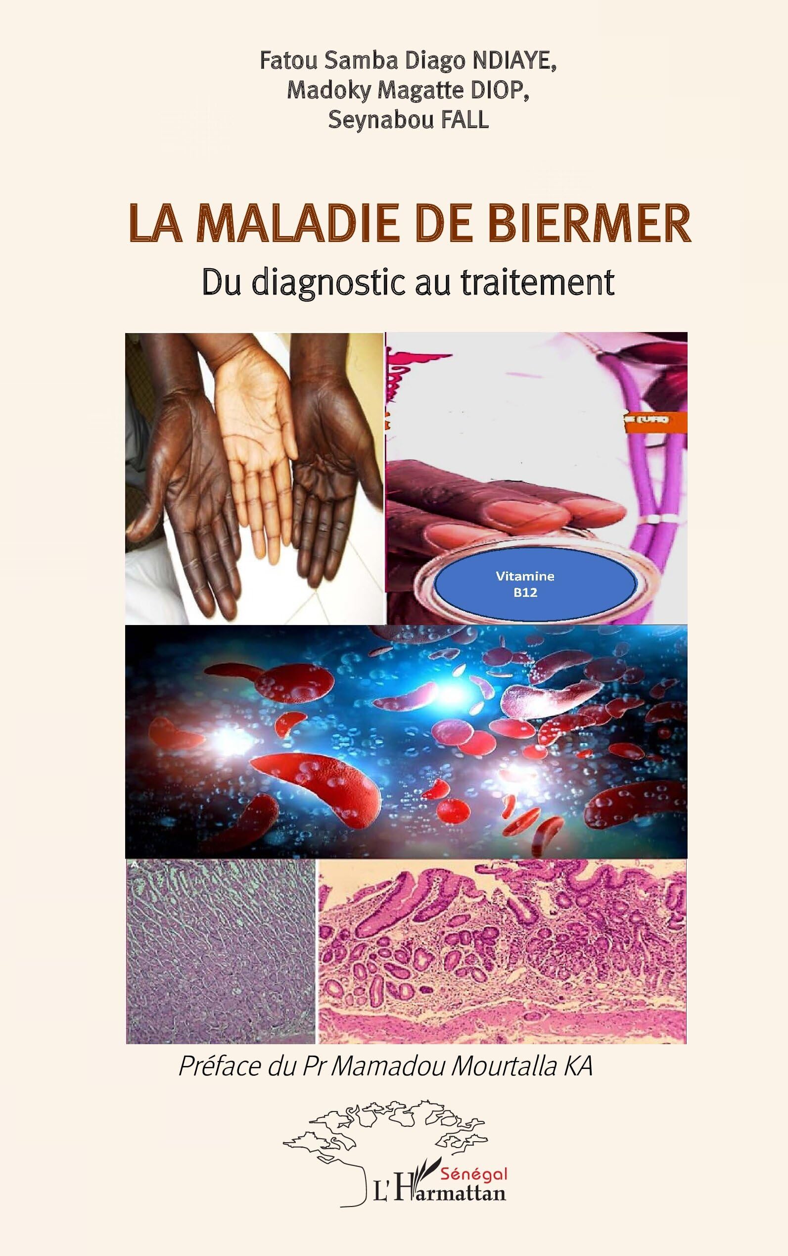 La maladie de Biermer: Du diagnostic au traitement
