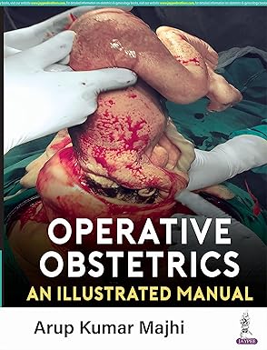 OPERATIVE OBSTETRICS: AN ILLUSTRATED MANUAL