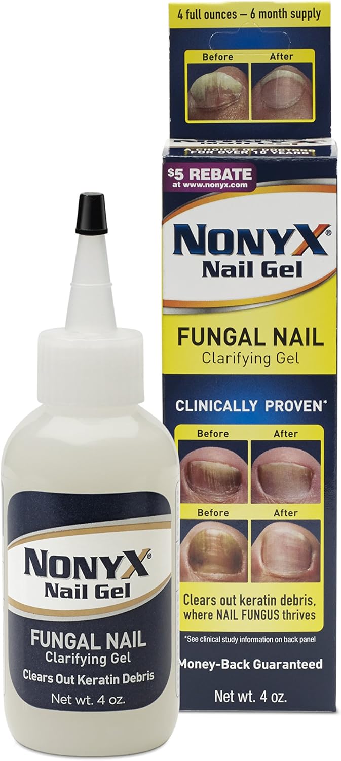 NonyX Nail Gel 4 oz (Pack of 6)