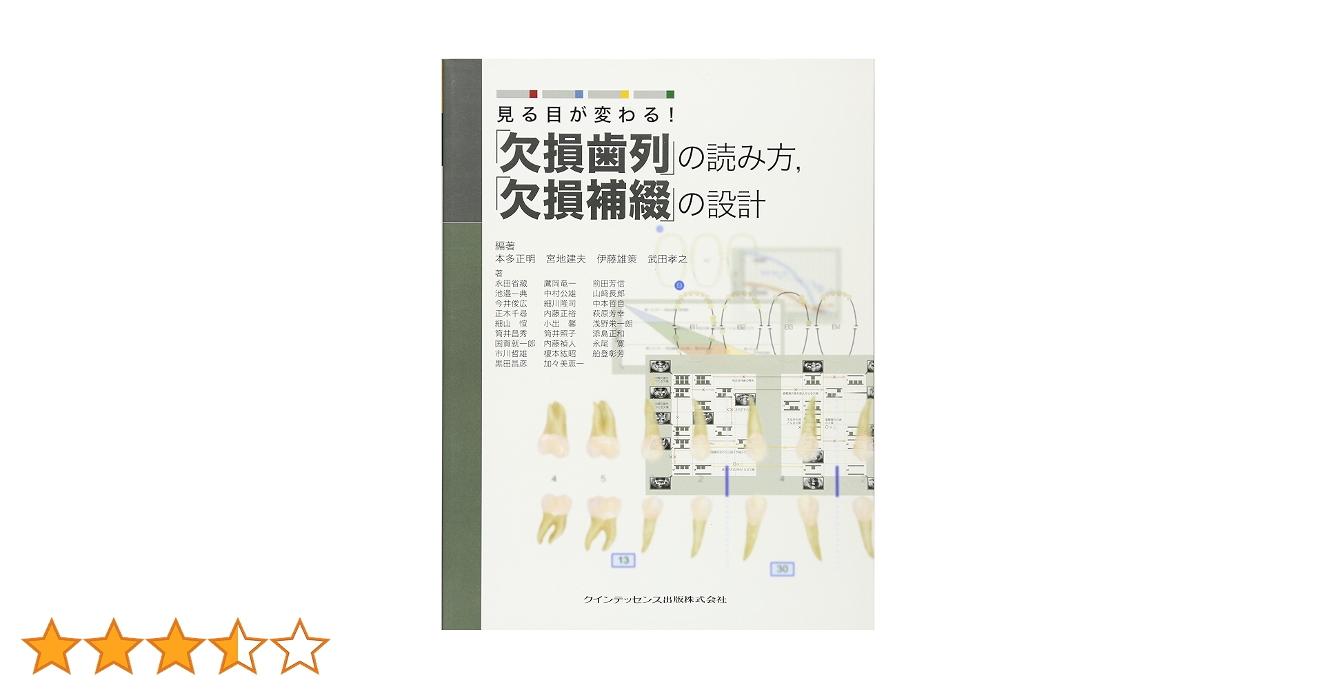 裁断済　見る目が変わる！　「欠損歯列」の読み方，「欠損補綴」の設計 見る目が変わる! 「欠損歯列」の読み方,「欠損補綴」の設計 | 本