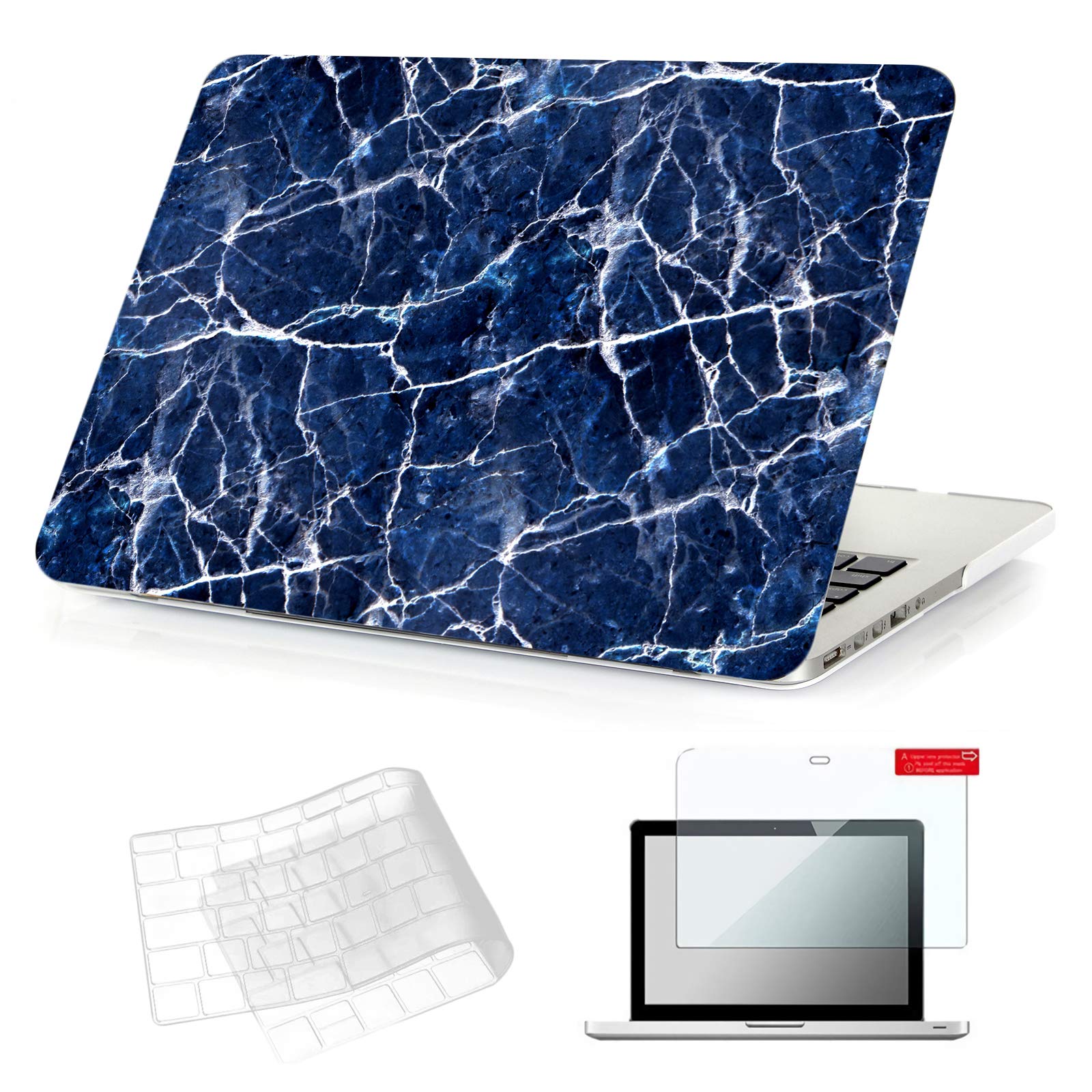 Se7enline Compatible with 13.6 MacBook Air Case M2 M3/M4 2022-2025 for Mac Air 13.6-inch A2681/A3113/A3240 Laptop Hard Shell Case with Keyboard Protective Cover & Trackpad Protector, Colorful Floret — view 81