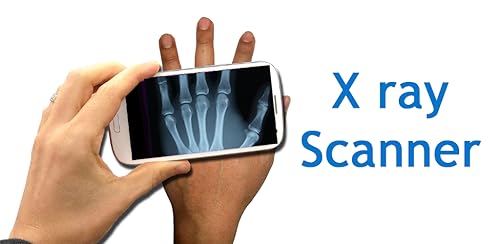Body X Ray Scanner