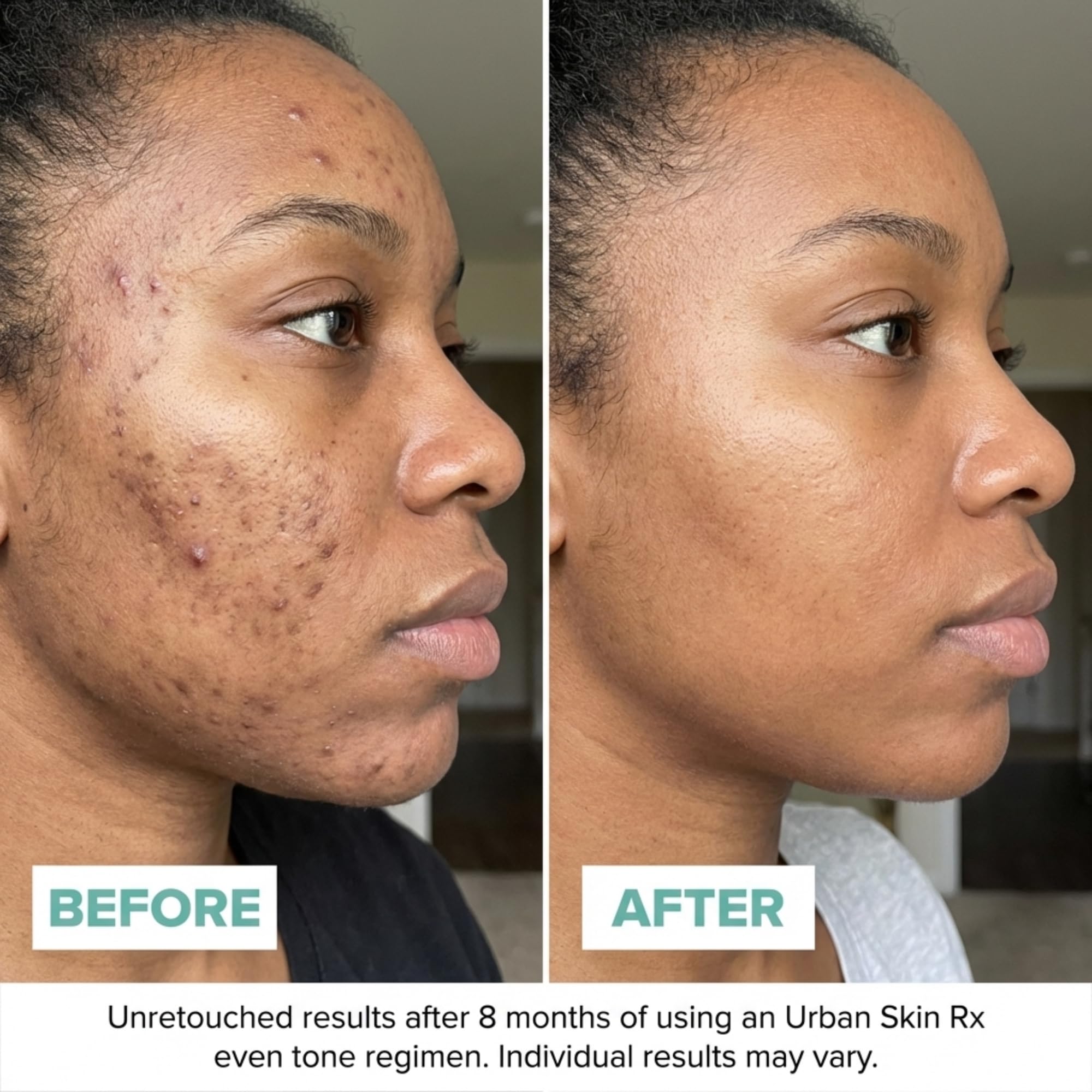 urban skin rx glutathione 3-in-1 Even Tone Cleansing Bar Talk about a game Urban Skin Rx Even Tone