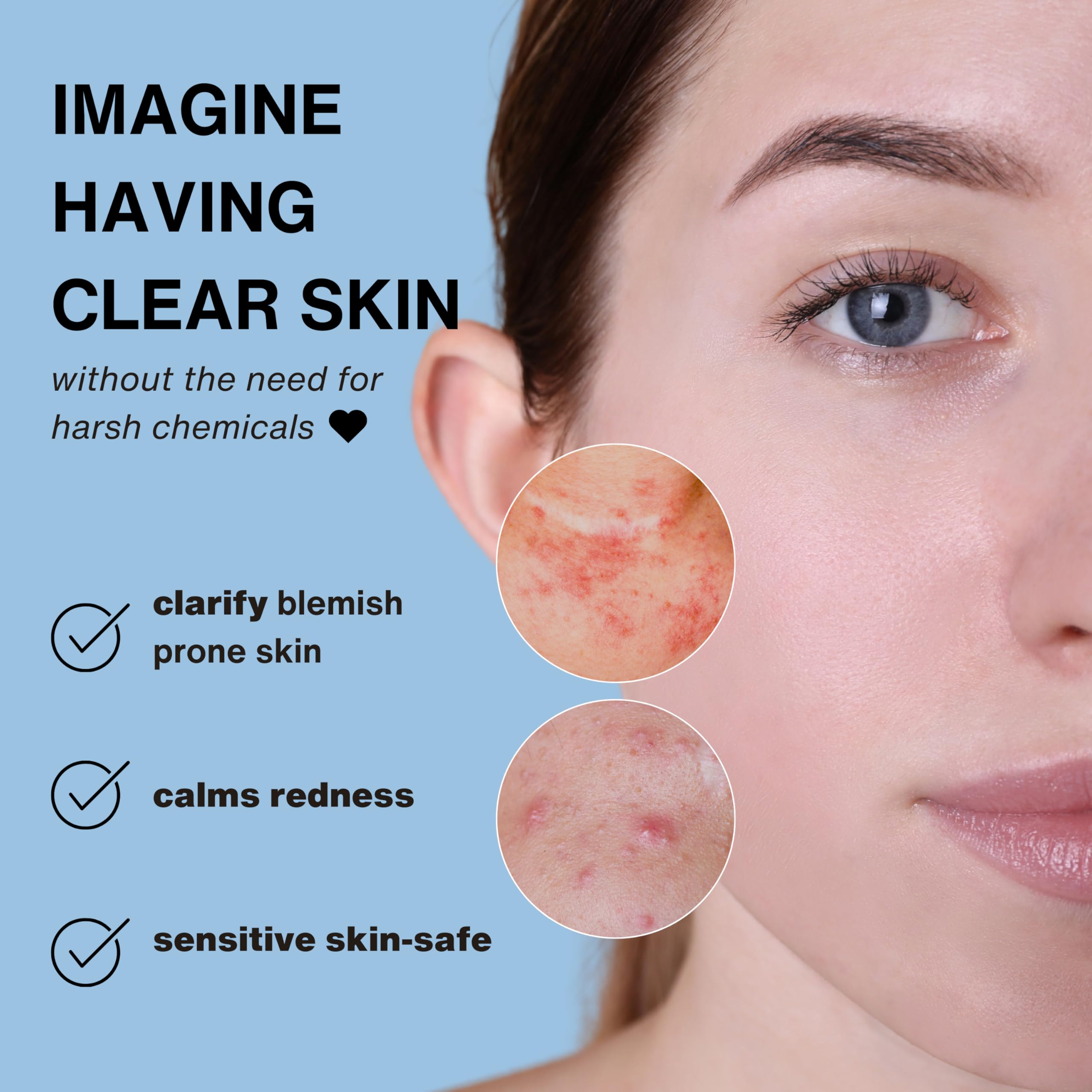 Vital Liquid - Daily Hypochlorous Acid Cleansing Spray for Sensitive Skin - Travel Size - Face, Back & Body Acne, Redness, Face & Scalp & Hand Eczema, Targets Bacteria, Makeup Brush Cleaner