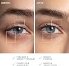 FOREO A Wink 'n' a Smile Bundle - BEAR 2 eyes & lips جهاز تنعيم التيار الصغير + FOREO SUPERCHARGED Eye & Lip Contour Booster Serum 3x3.5ml - Dark Circles Under Eye Treatment & جهاز بثور الشفاه