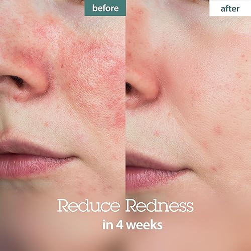 Vista 5 de BLITHE Kbeauty - Suero prensado Crystal Iceplant Gel hidratante facial – Kbeauty Best Skin Cream para piel seca, suero coreano para piel mixta