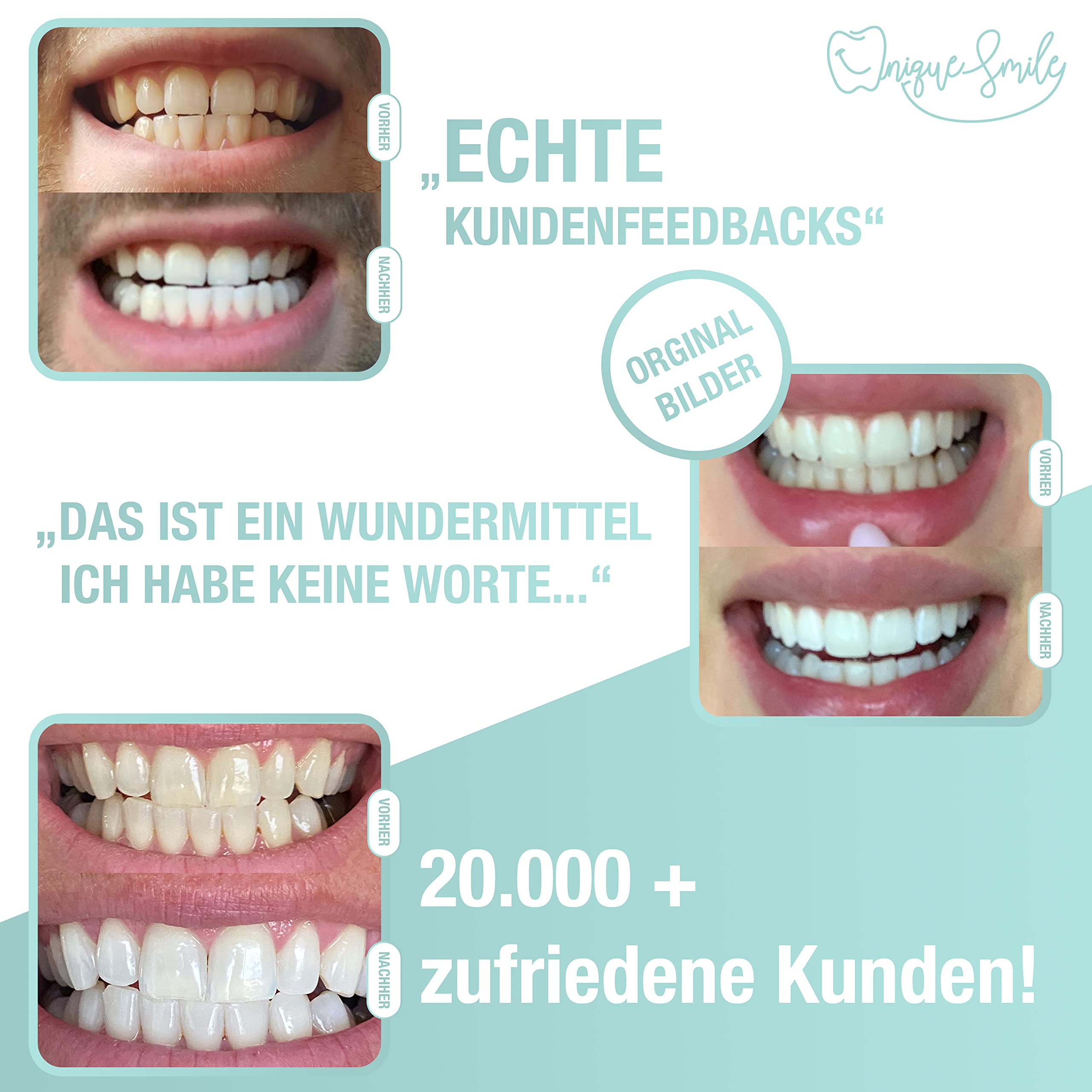 UniqueSmile Kit de teeth whitening de haute qualité pour éclaircissement des dents et dents blanches - 100 jours d'essai sans risque