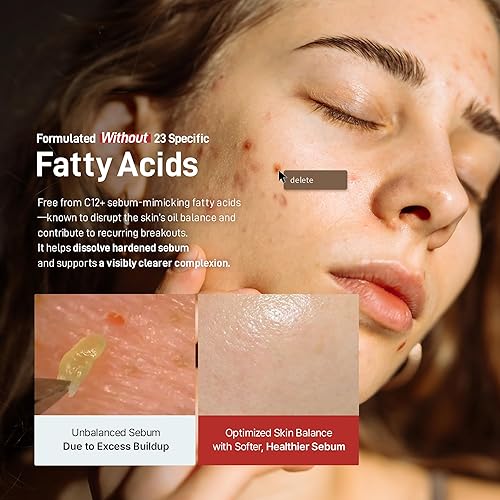 Miniatura 6 de Crema Zeroca 81 Crema hidratante coreana de rosa silvestre para piel sensible y propensa al acné, controla el sebo, hidratación ligera para una