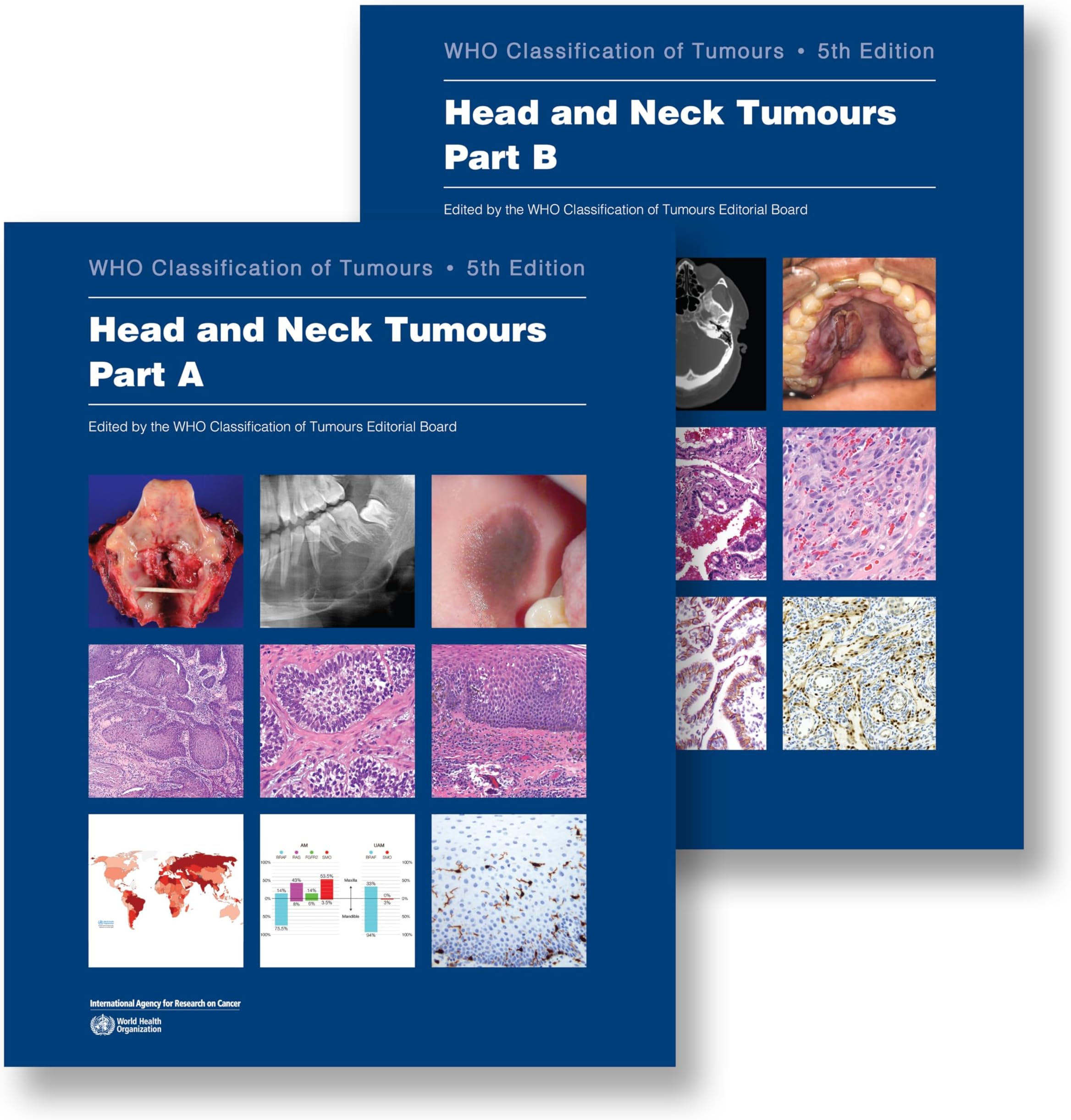 Head and Neck Tumours: WHO Classification of Tumours