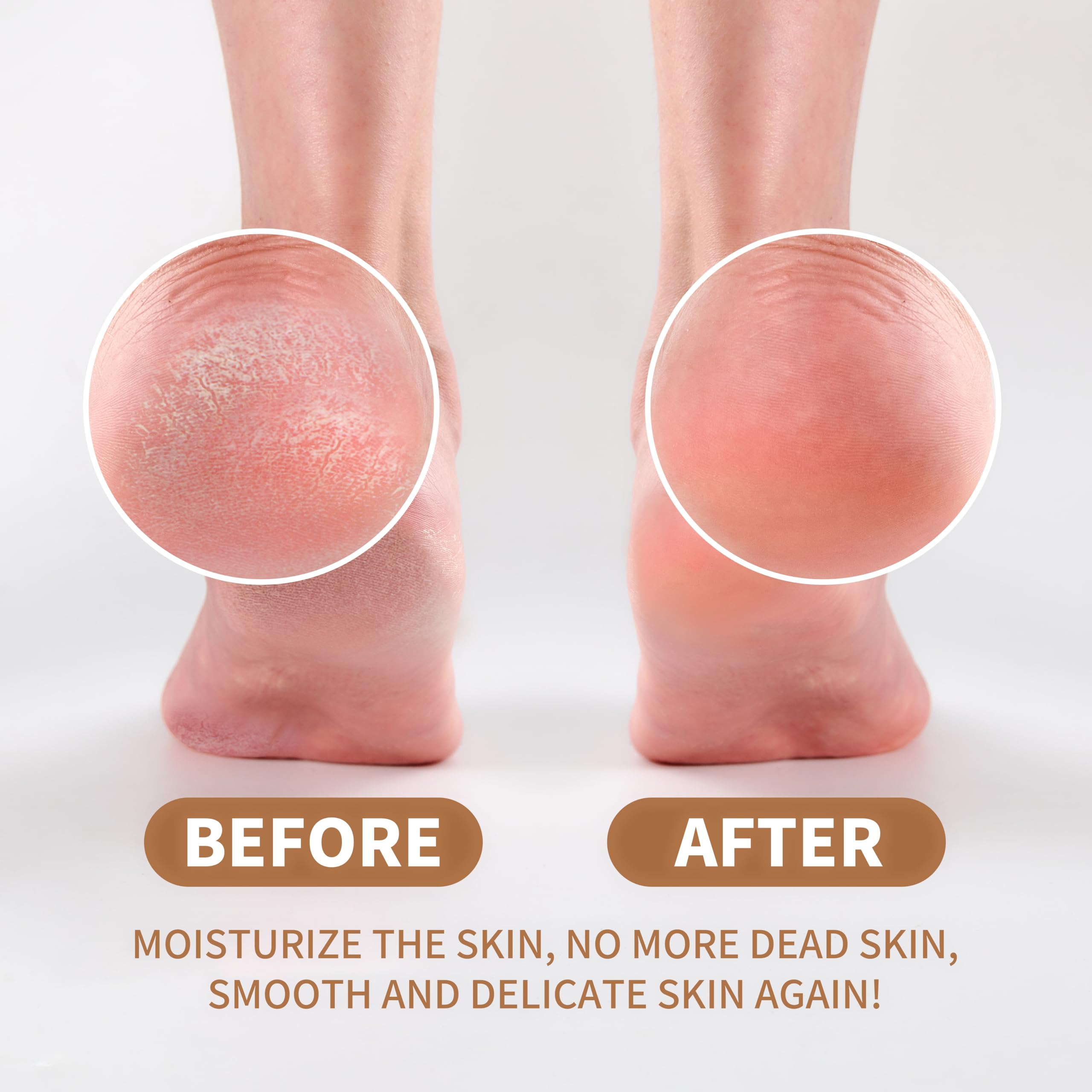 フットケア aya Amazon.com : Yaya Callus Remover for Feet - Extra Strength