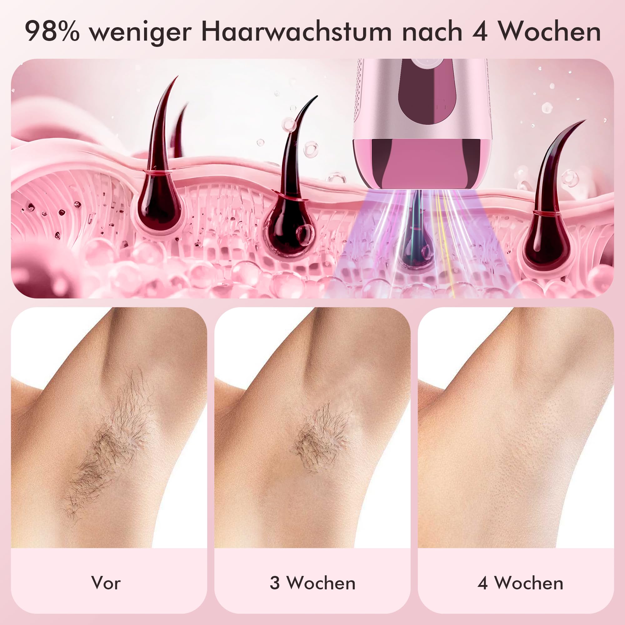 IPL Geräte Haarentfernung mit Kühlung Funktion, Schmerzfreie Laser Haarentfernungsgerät zu Hause 5 Energiestufen für Gesich Bikinibereich Körper - Rosa