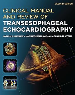Clinical Manual and Review of Transesophageal Echocardiography, Second Edition