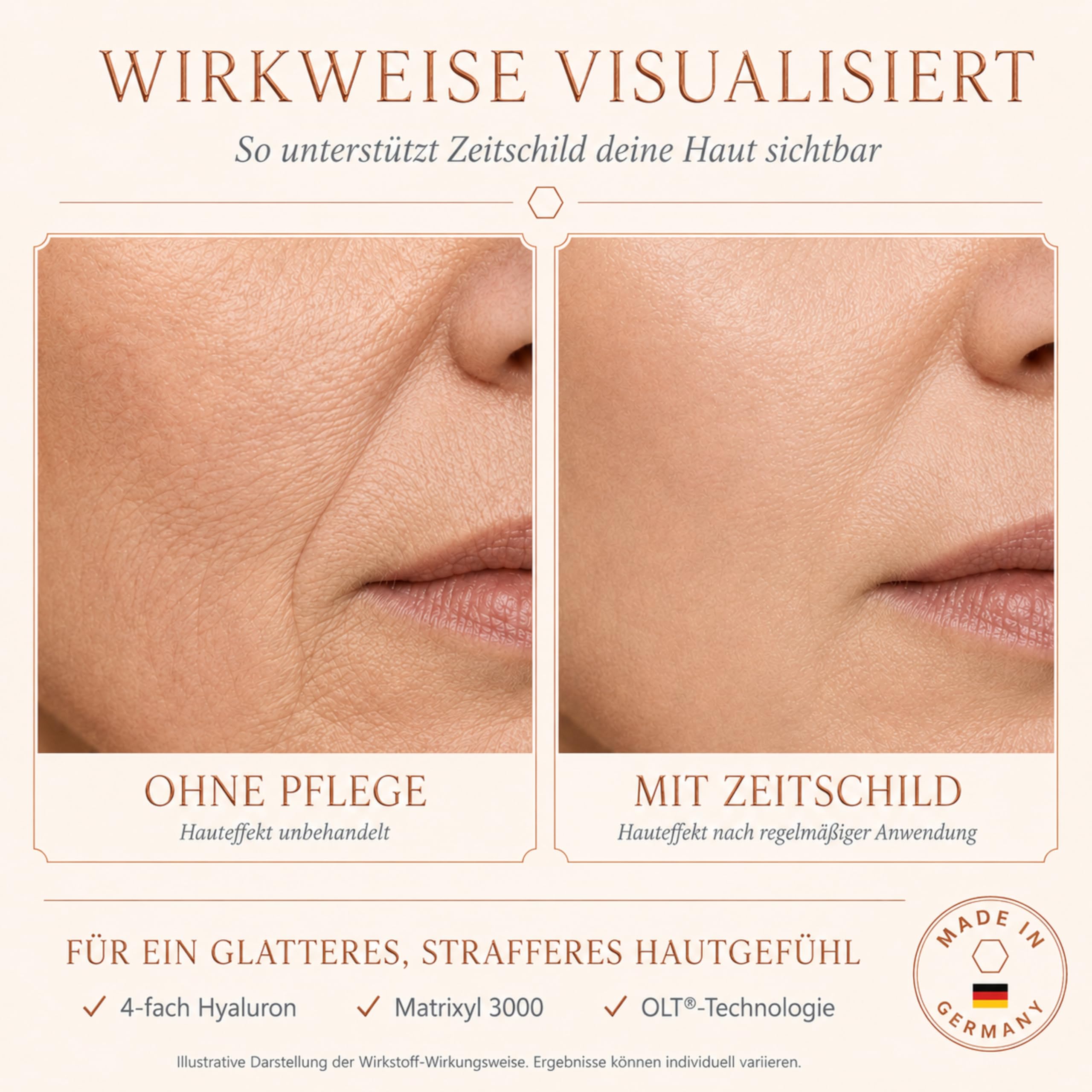 Anti Falten Serum Hochdosiert mit 4-fach Hyaluronsäure Matrixyl 3000 & OLT® - Anti-Aging Hyaluron Gesichtsserum gegen Tiefenfalten - Reife Haut Frauen Männer 30ml Made in Germany