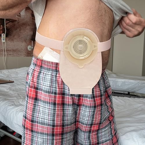 Miniatura 4 de 3 correas ajustables para ostomía que se fijan de forma segura a la bolsa de ostomía de 1.18 x 40 pulgadas, evitando deformaciones del chasis,