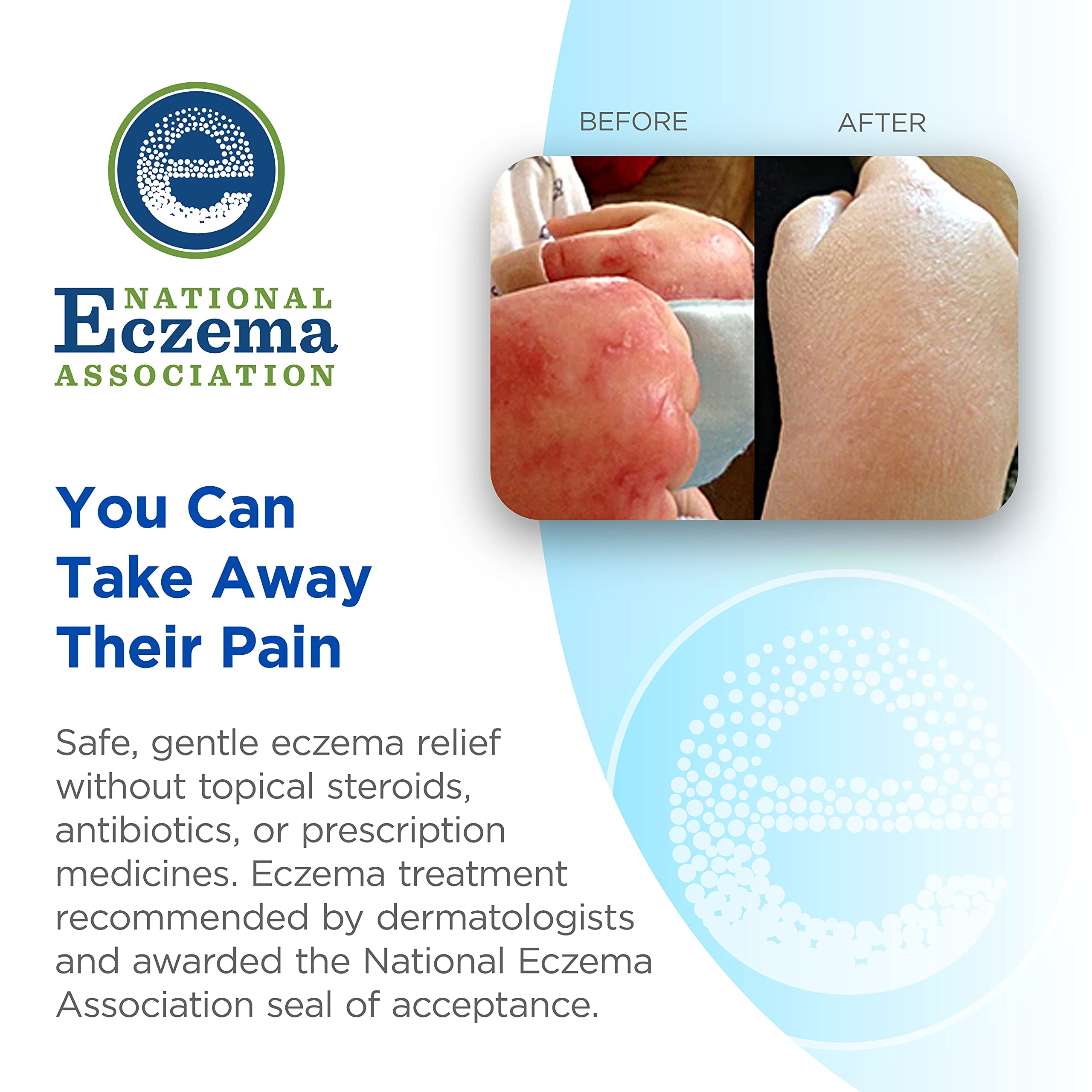 WrapESoothe UltraSoft NonItch Eczema Body Suit for Toddlers (2