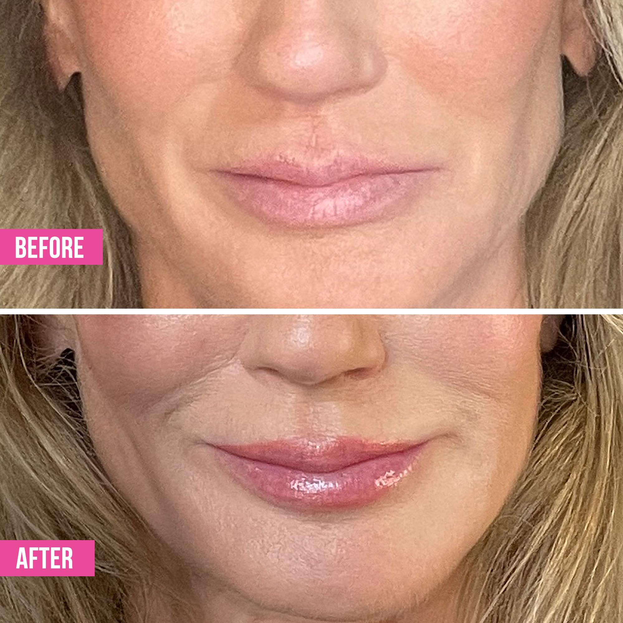 Volumizador hidratante para labios, brillo voluminizador con ácido hialurónico, suaviza líneas y arrugas, 0.14 onzas líquidas 4
