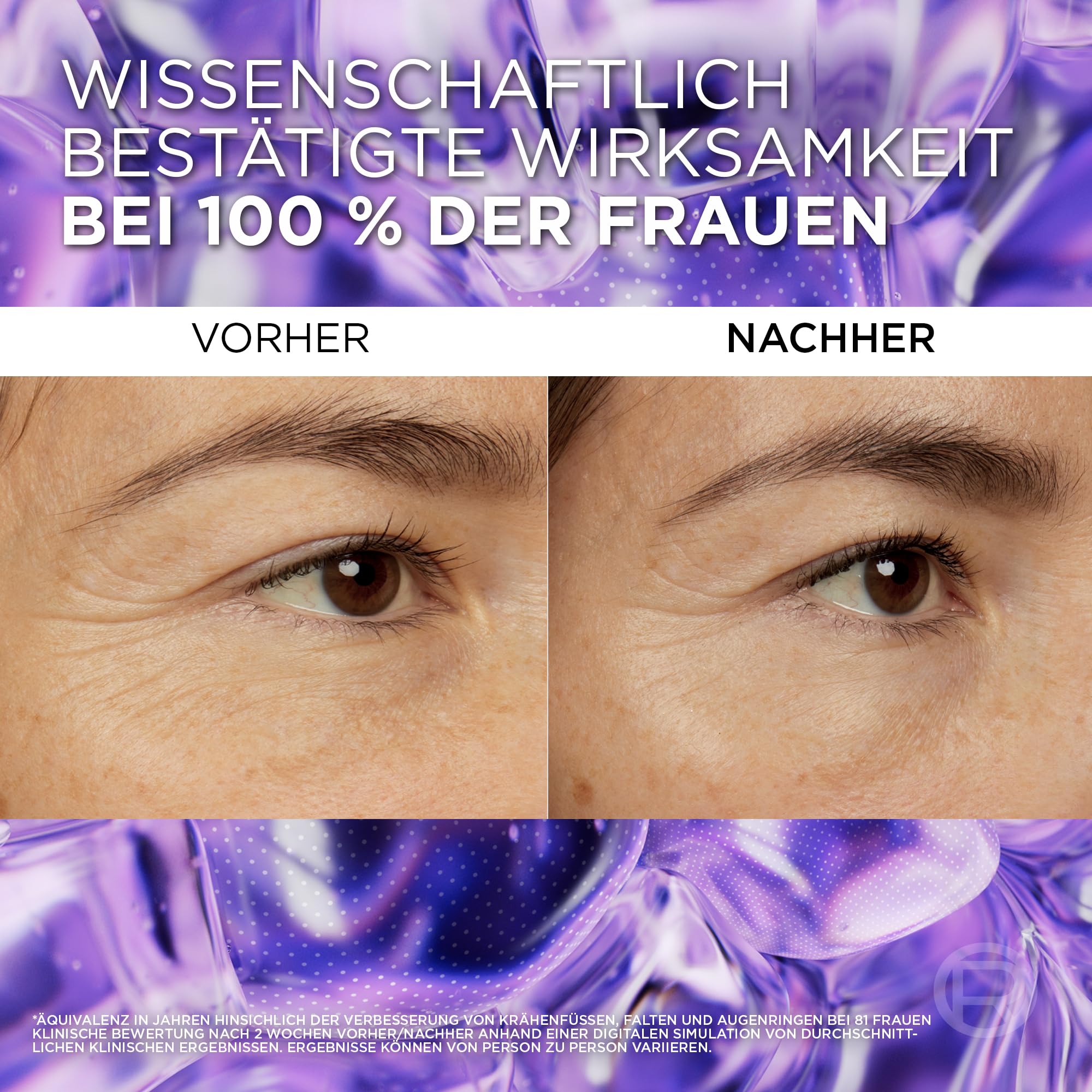 L'Oréal Paris Sérum contour des yeux pour femme : fournit un contour des yeux rembourré et moins de cernes avec 2,5% [acide hyaluronique + caféine], Revitalift Filler, 1 x 20 ml