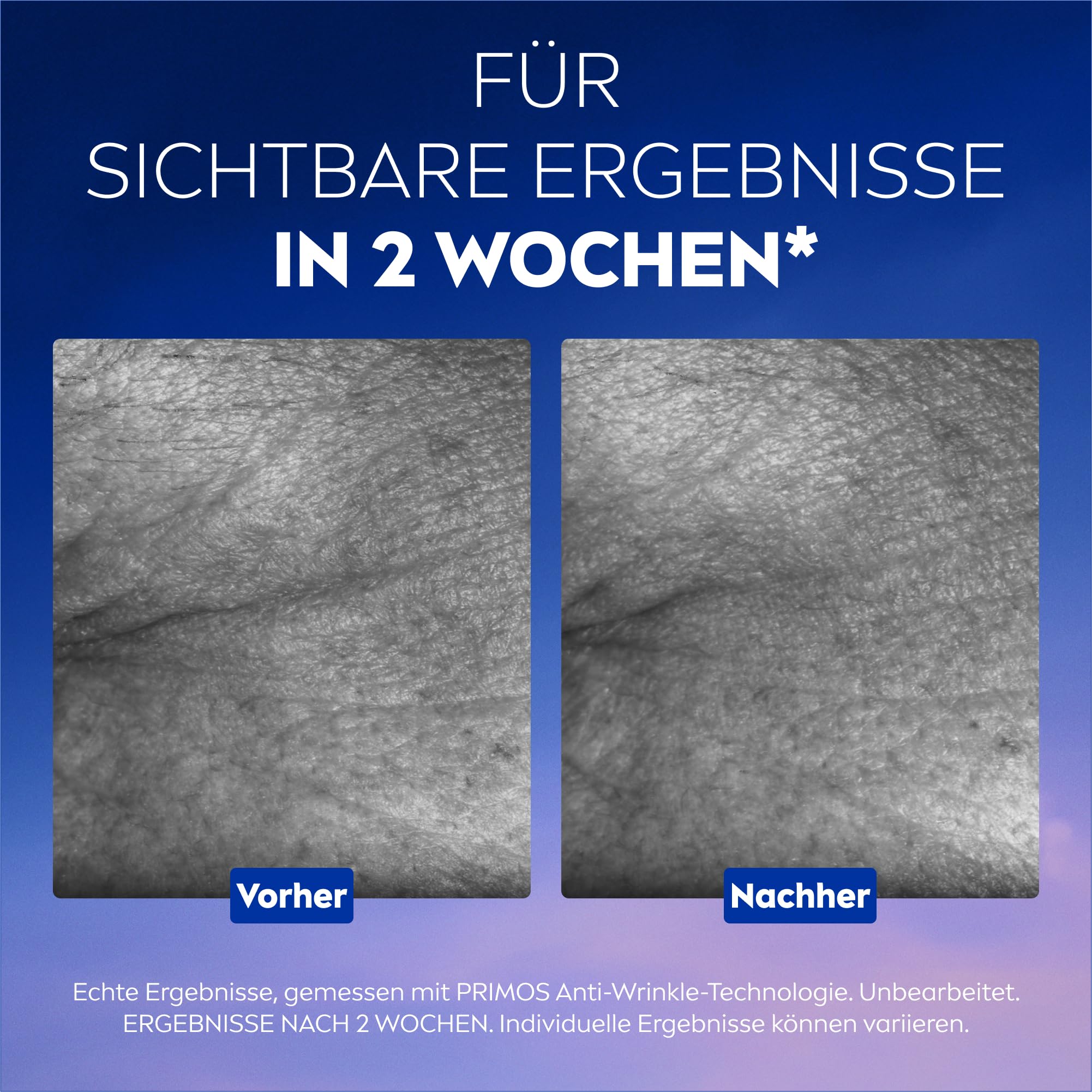 NIVEA Cellular Epigenetics Verjüngendes Serum mit EPICELLINE, setzt das Hautalter in 2 Wochen zurück, revolutionäre Gesichtspflege mit 3 Arten Hyaluronsäure (30 ml)