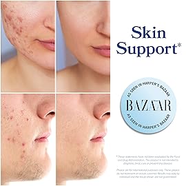 DIM Supplement 200 mg | Estrogen Balance for Women & Men | Hormonal Acne, Hormone Balance, Menopause & Antioxidant Support | Clean Label Project Certified, Vegan & Soy Free Diindolylmethane | 60 Ct.