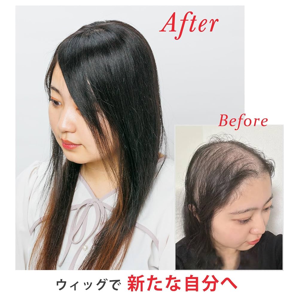 総手植え★人毛100％余裕の長さ25.4cm~30cm黒髪ヘアピース★自然な地肌 人毛100％ 総手植え ナチュレトップヘアピース 選べる4タイプ
