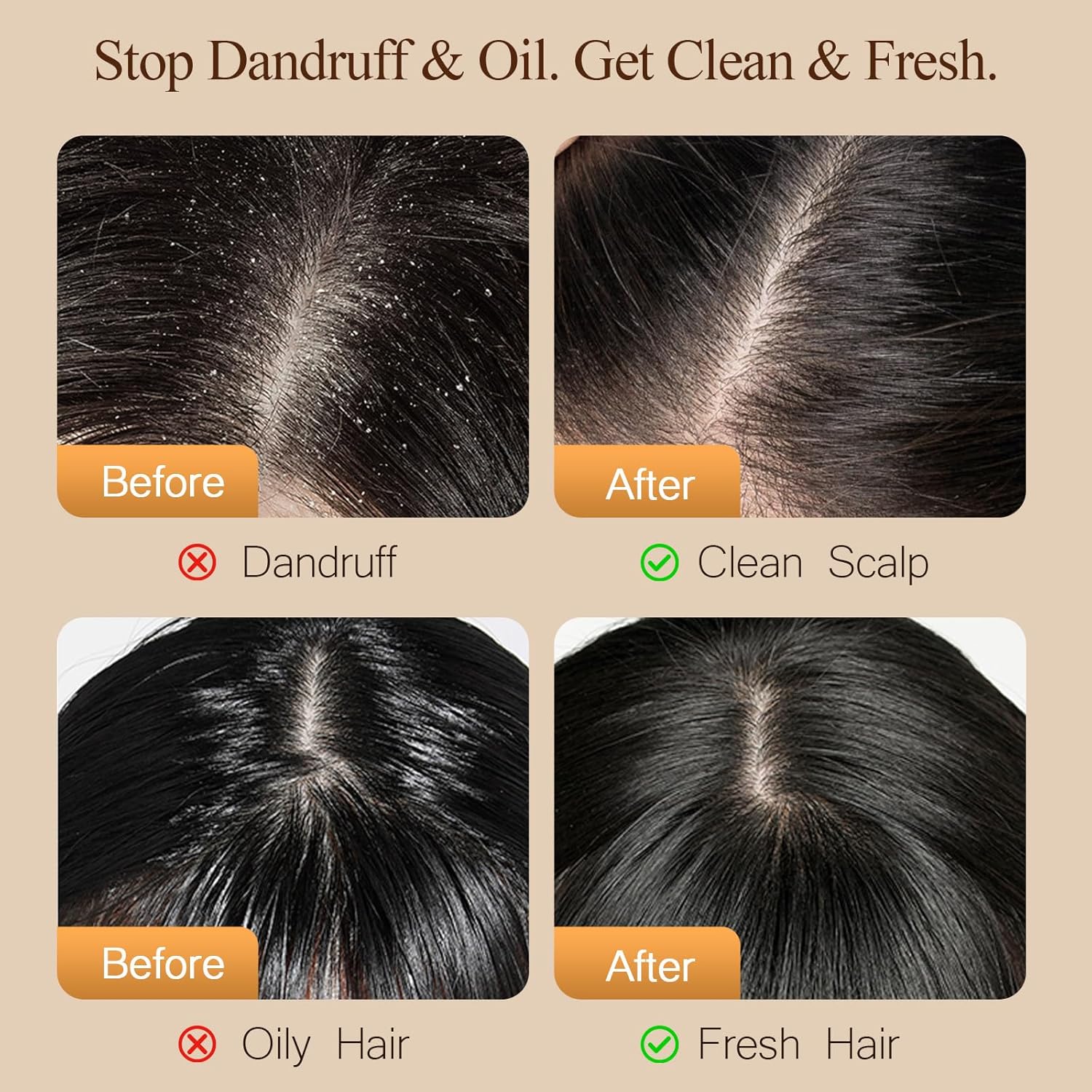 Dear Irean Shampoo and Conditioner Set, Anti Dandruff Oil Control Repair Shampoo and Conditioner, Sulfate Free with Argan Oil for Women, Hair Gloss Treatment for Oily, Dry, Damaged, Curly Hair 30.4 Oz