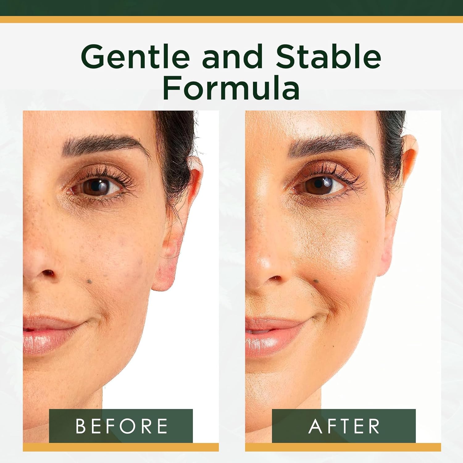 Tree of Life Beauty Vitamin C Skin Care Set, Skin Face Oil, Facial Serums for Dry and Sensitive Skin with Hyaluronic Acid & Vitamin E Soft Skin, 1 Fl Oz (Pack of 2) - Image 3