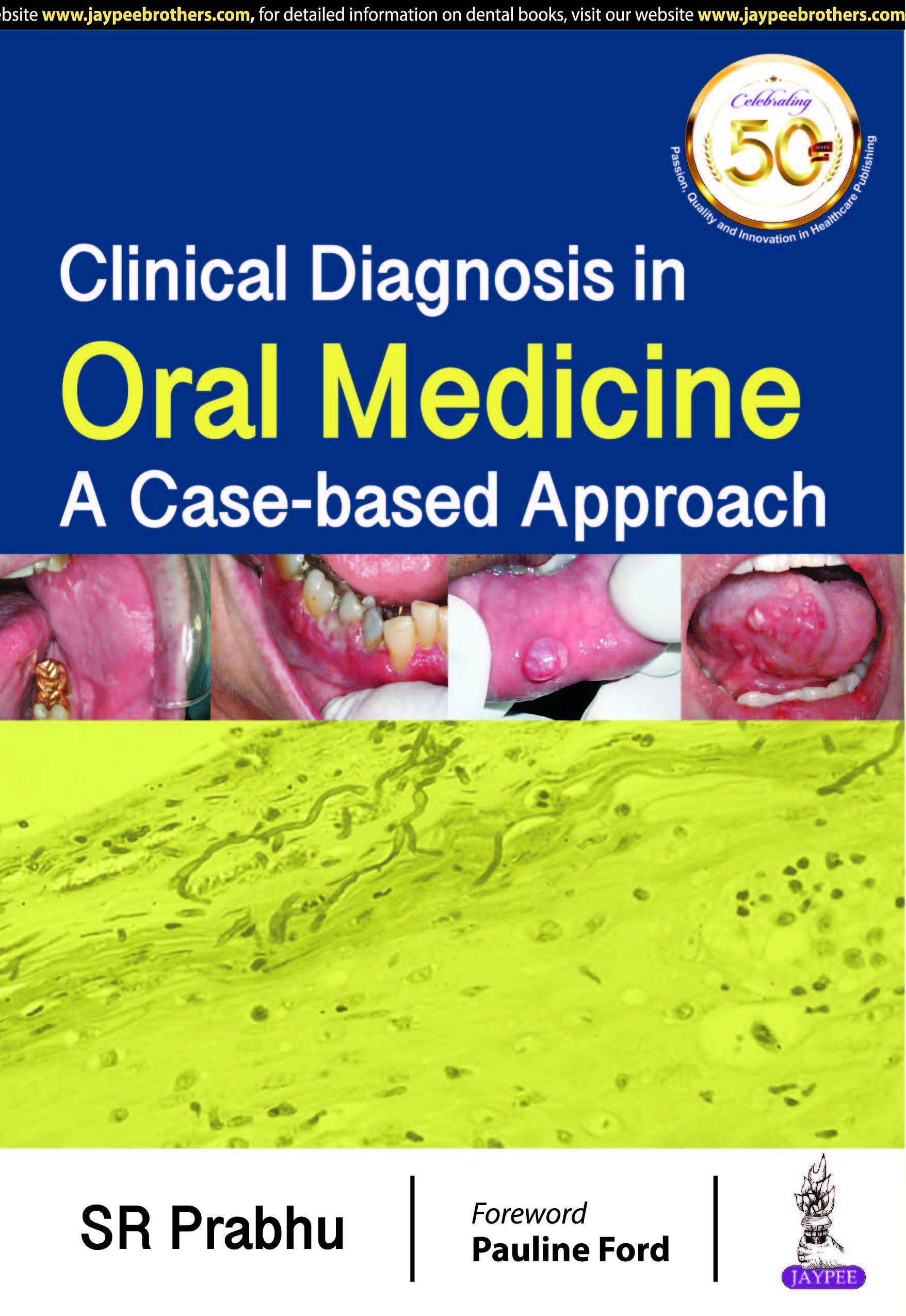 Buy Clinical Diagnosis in Oral Medicine: A Case-based Approach Book ...