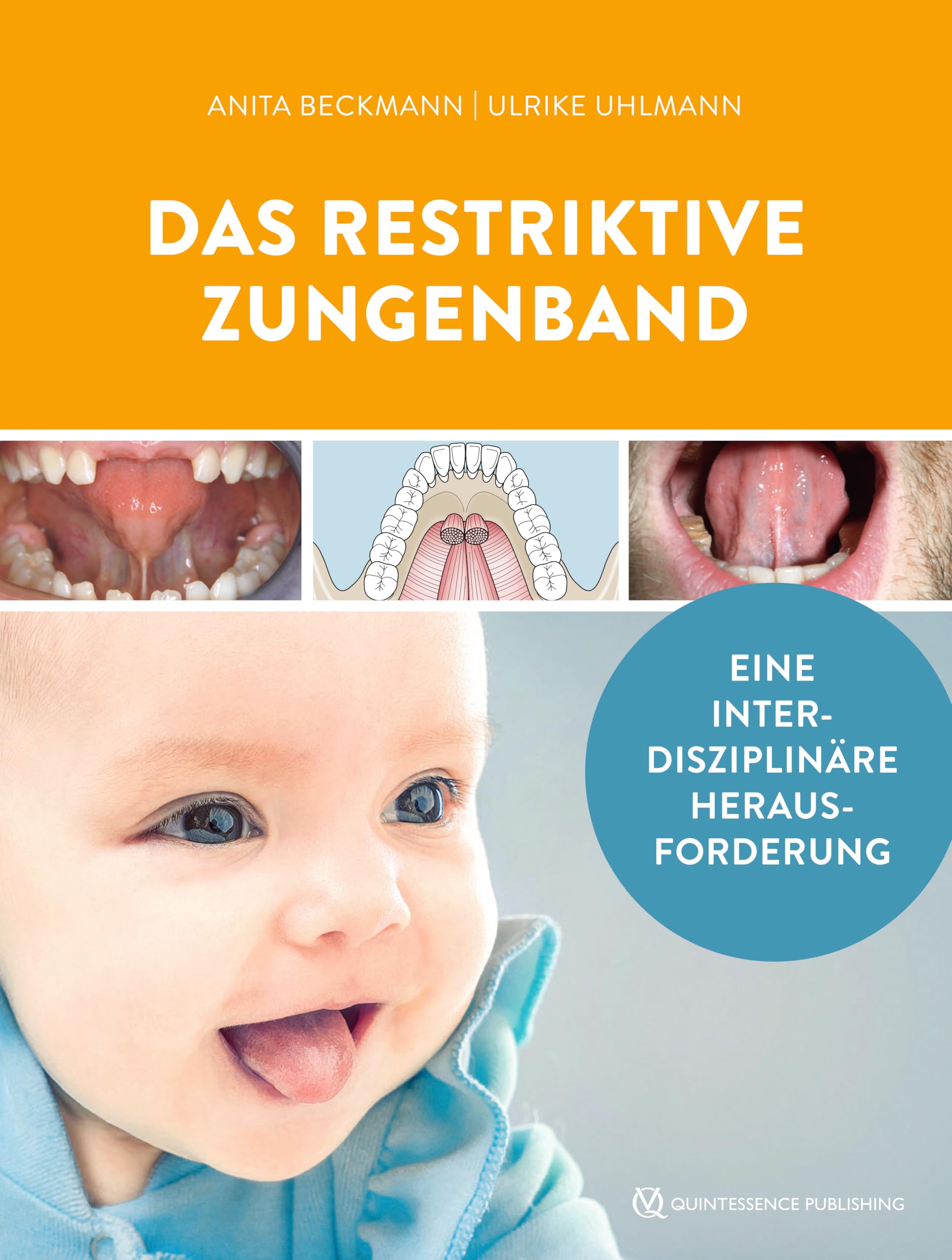 Das restriktive Zungenband: Eine interdisziplinäre Herausforderung