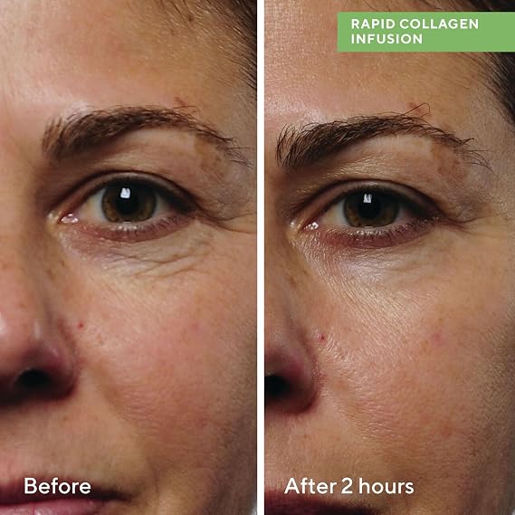 Murad Rapid Collagen Infusion Instant Firming Collagen Serum (30 ml)